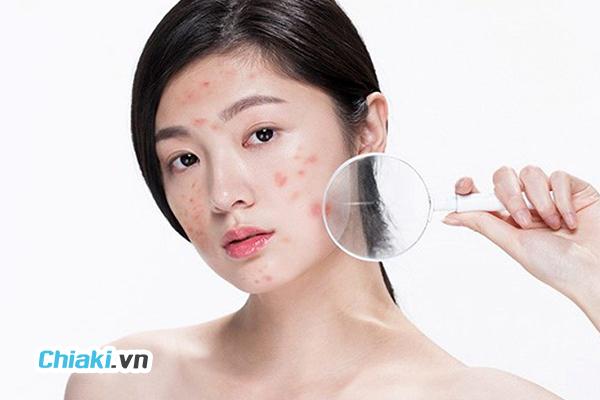 Đánh giá từ người mua sản phẩm