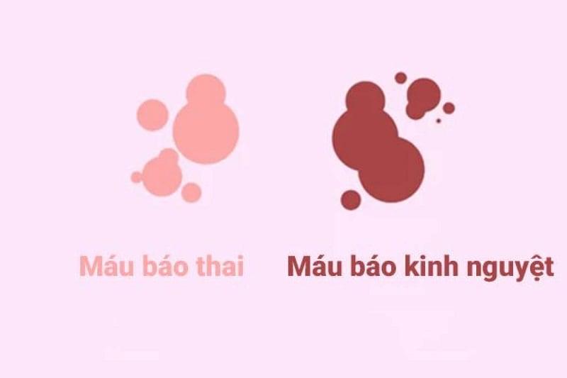 Máu báo thai là gì? Kéo dài bao lâu & Các triệu chứng kèm theo