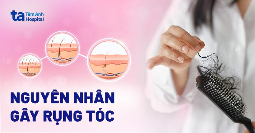 rụng tóc