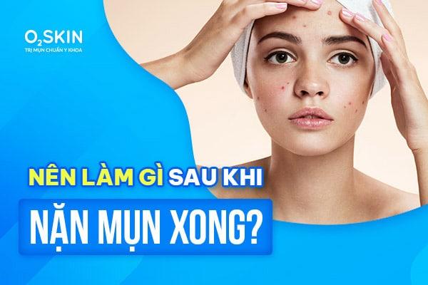 Nặn mụn xong nên làm gì?