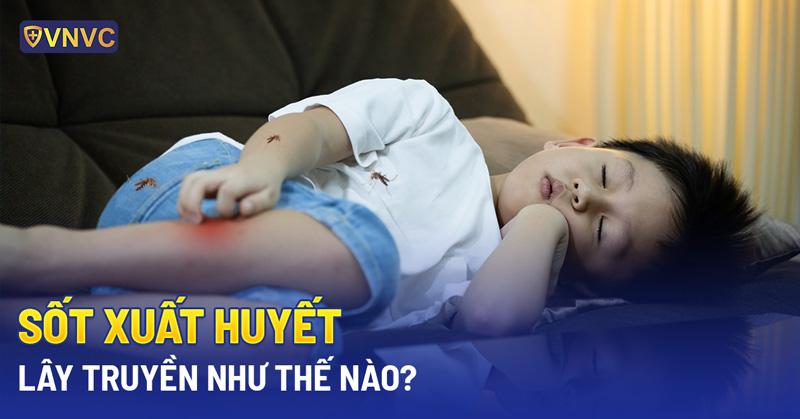 sốt xuất huyết có lây không