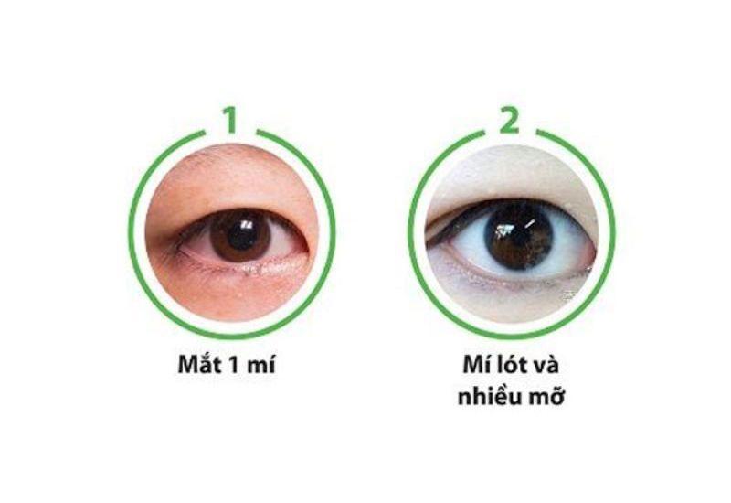 Phân biệt mắt mí lót và mắt 1 mí