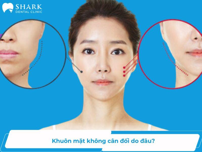 Khuôn mặt lệch sẽ dễ nhận biết bởi sự không cân đối của mũi, cằm, miệng của 2 bên mặt