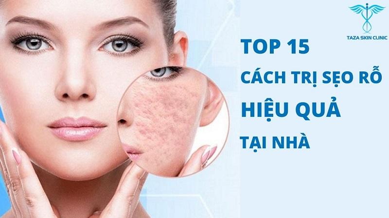 cách trị sẹo rỗ