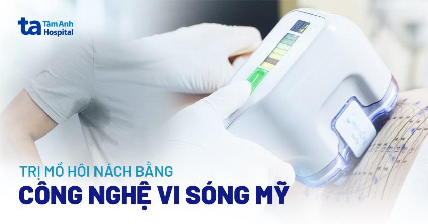 Công nghệ vi sóng trị mồ hôi nách