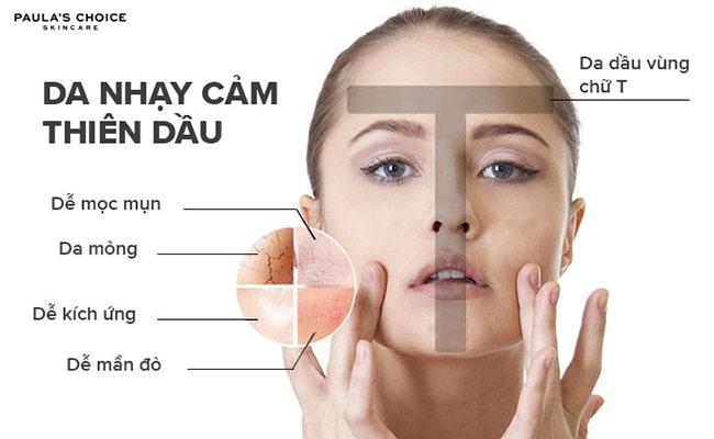 Đặc điểm của làn da dầu nhạy cảm, da dầu nhạy cảm có những đặc điểm gì