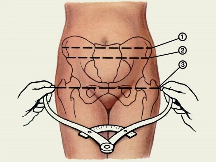 Xương chậu hẹp có sinh thường được không? DỄ hay KHÓ