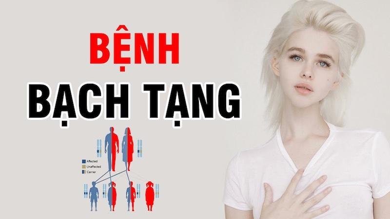 Bệnh bạch tạng là gì?