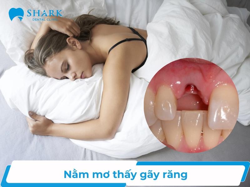 Nằm mơ gãy răng có thể do bạn cảm thấy tự ti về ngoại hình hoặc đang gặp những khó khăn trong cuộc sống