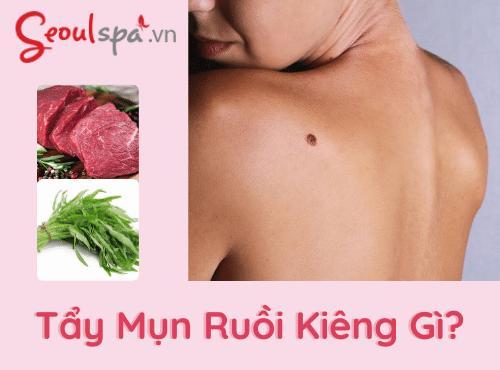 Sau khi tẩy mụn ruồi kiêng gì