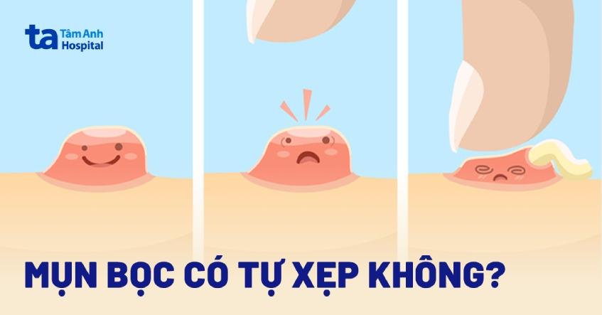 mụn bọc có tự xẹp không